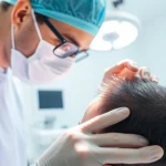 Gain insights on hair transplant istanbul price during a professional procedure consultation.