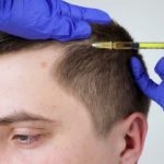 Sapphire Hair Clinic Hair Transplant Turkey for Men & Women